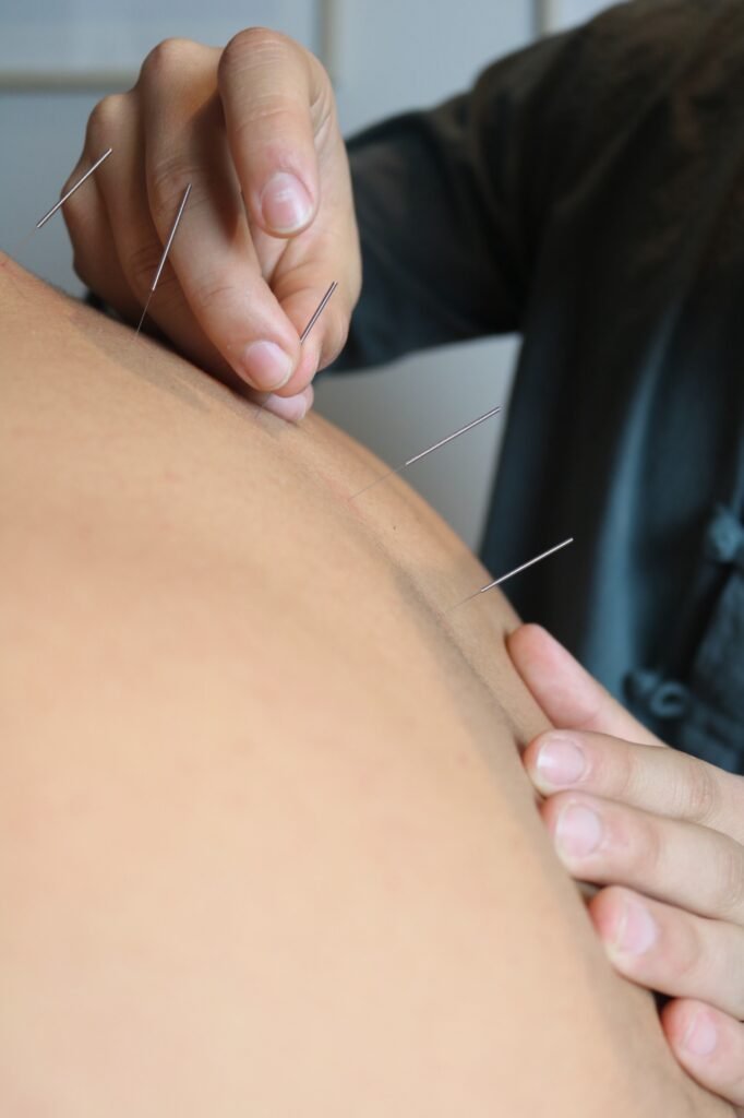 Acupuntura: la sabiduría milenaria que hoy revoluciona la salud integral 1 img 0568 1